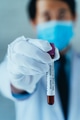 Asian male doctor holding blood Coronavirus (Covid 19) sample test for positive values - PhotoDune Item for Sale