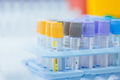 Vacutainer, blood collection tubes for hospital, healthcare, medicine science lab for background - PhotoDune Item for Sale